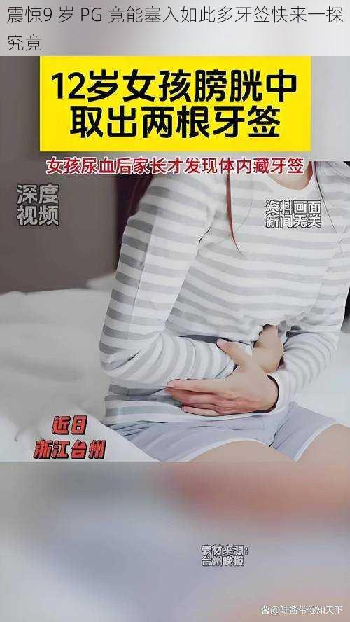 震惊9 岁 PG 竟能塞入如此多牙签快来一探究竟